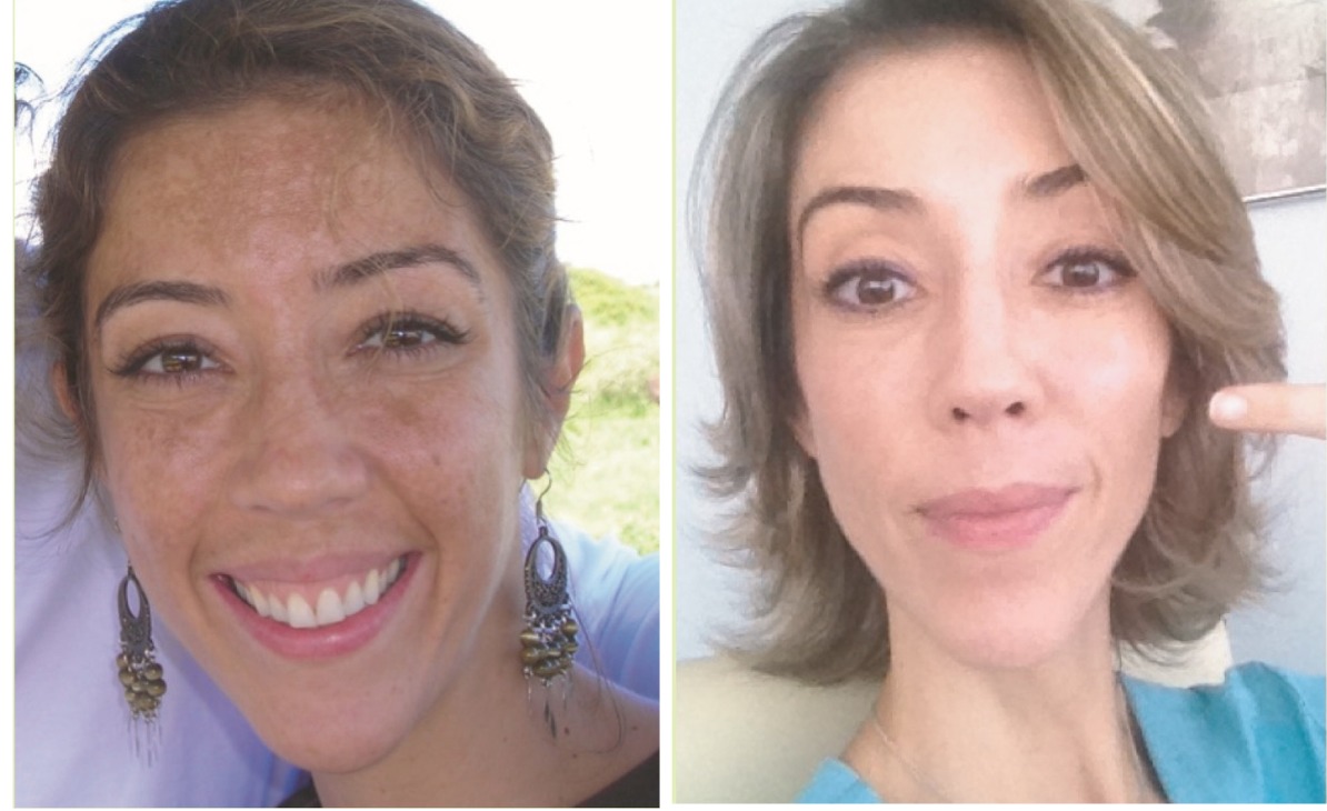 Gleaming Skin - Clínica Estética Carvajal Panamá 3