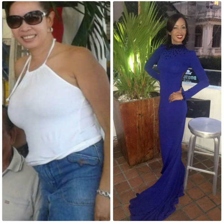 Electro Fit - Clínica Estética Carvajal Panamá 2