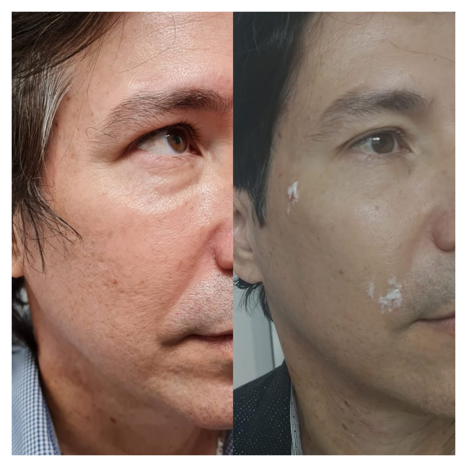 Total Make Over - Clínica Estética Carvajal Panamá 2
