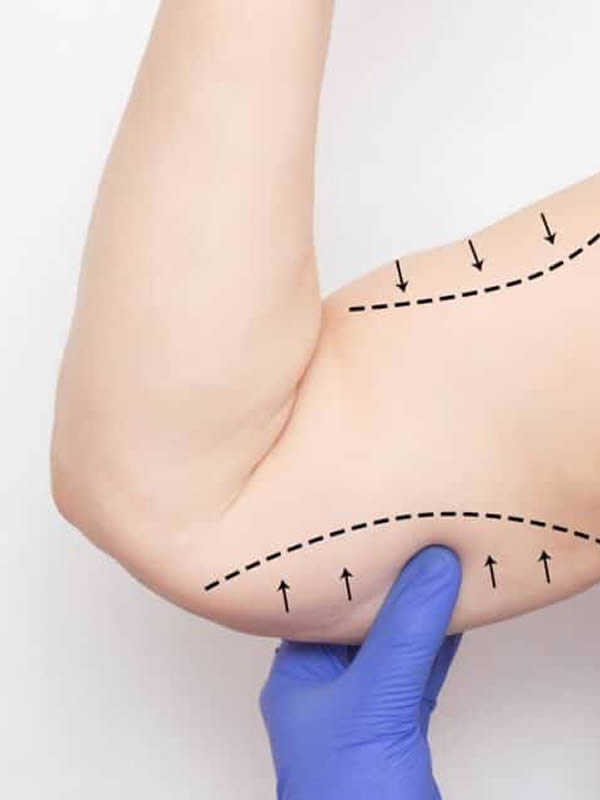 Acthyderm Brazos - Clínica Estética Carvajal Panamá 2
