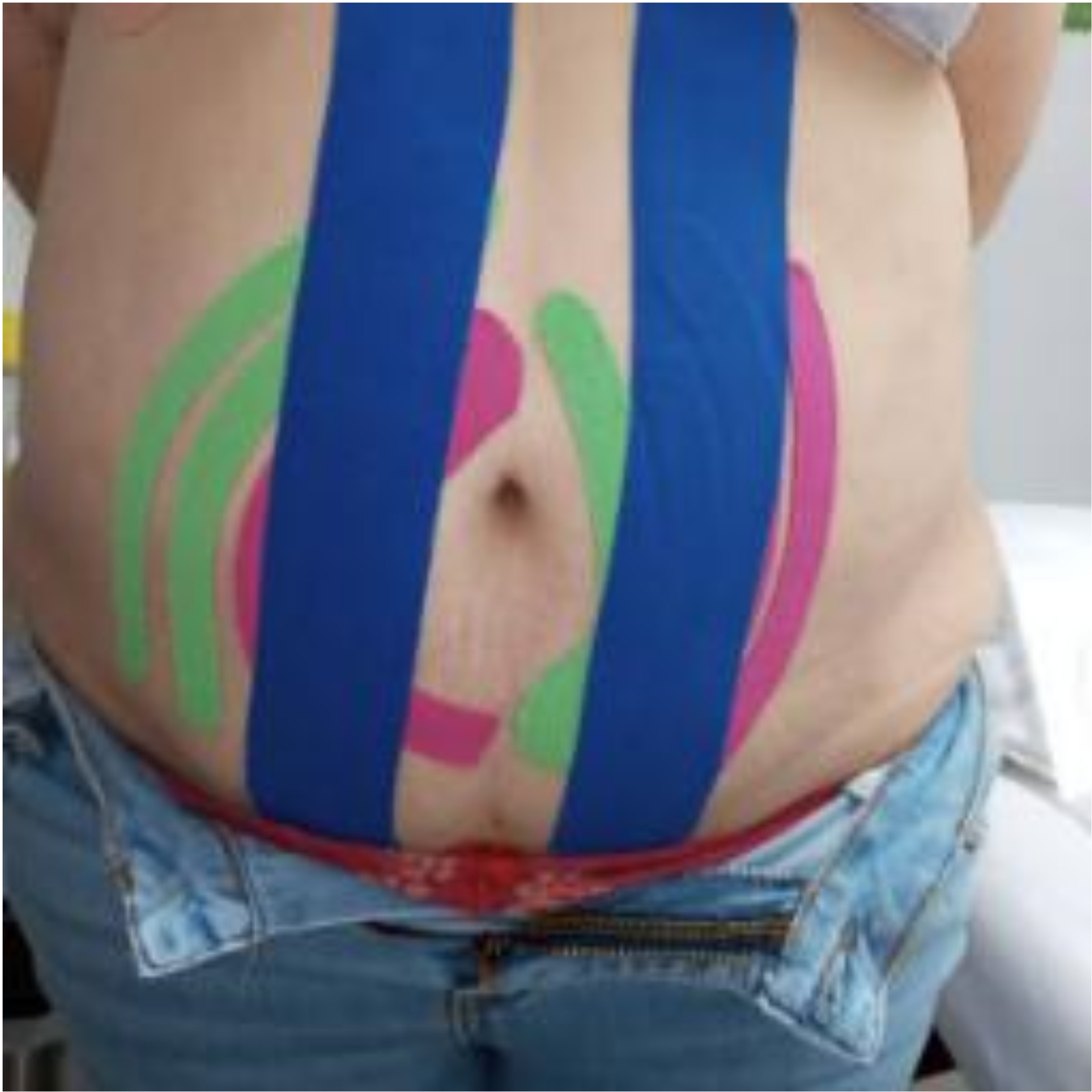 FisioTape - Clínica Estética Carvajal Panamá 8