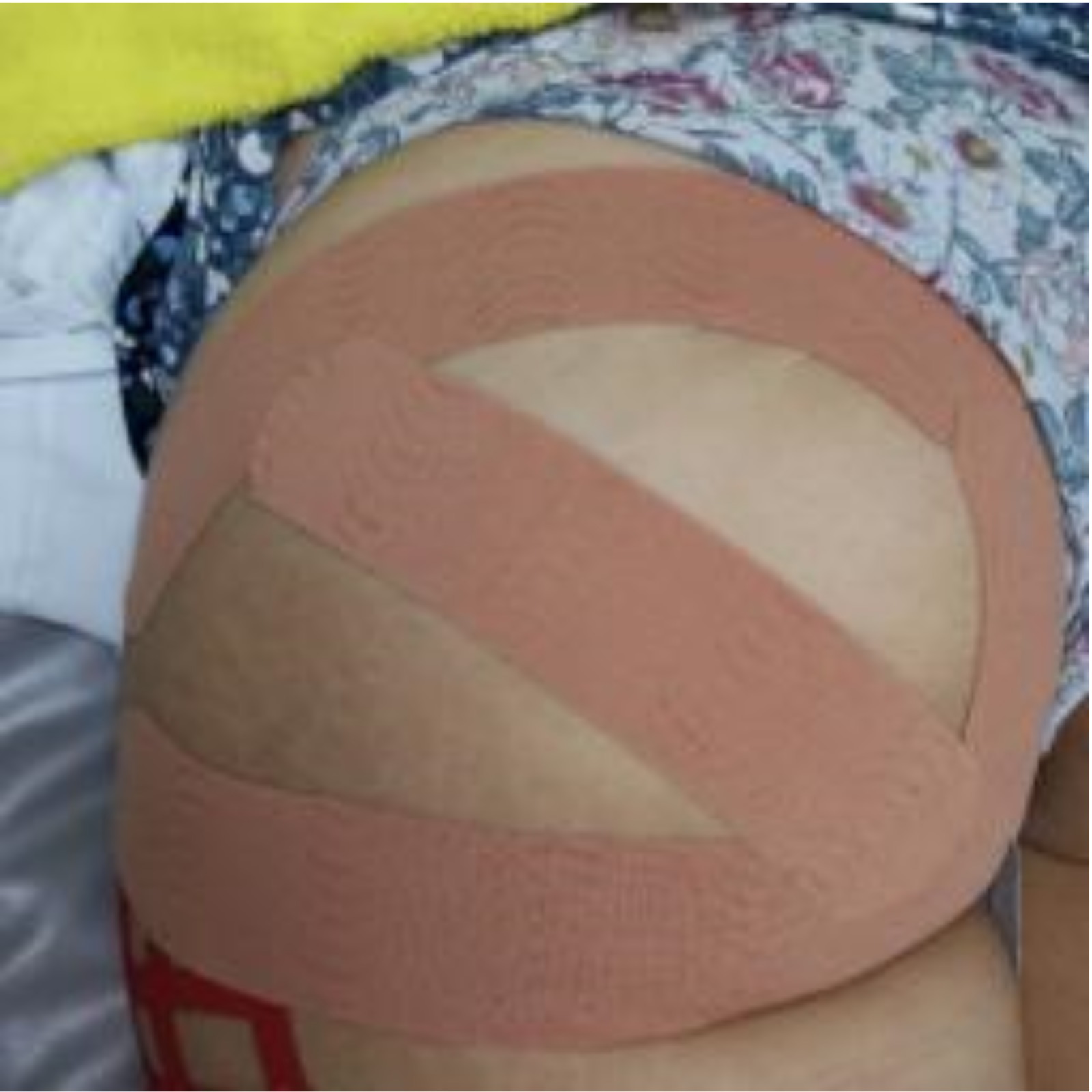 FisioTape - Clínica Estética Carvajal Panamá 5