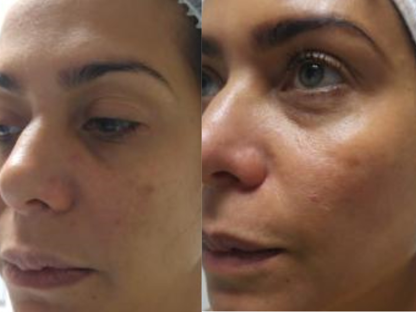 Péptidos Rejuvenecedores - Clínica Estética Carvajal Panamá 3