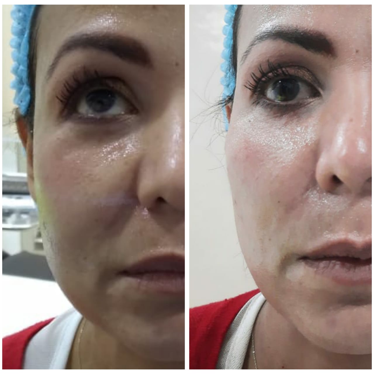 Urban Treatment - Clínica Estética Carvajal Panamá 2